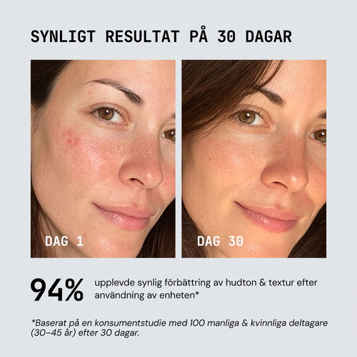 Halia rödljusterapi enhet | 4-in-1 Rödljust, EMS, Soniska vibrationer & Värmestav